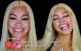 What is the best place to go to in Miami to get my veneers f