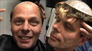 Her blir Robinson-Tommy parykk-Tommy