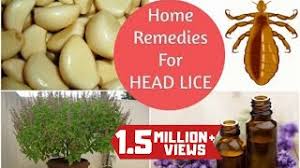 Salt and vinegar salt is an effective method of killing lice through dehydration. Top 5 Home Remedies To Get Rid Of Head Lice Nits Sushmita S Diaries Youtube