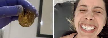 Take the mixture and rub it onto the hairy area for two minutes. I Tried Sugaring To Get Rid Of My Pubic Hair