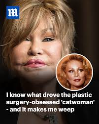 Too many young women today are all little Jocelyn Wildensteins. This is the  real pandemic' 💔 Read more: https://trib.al/L6ROQHx