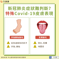 This is 伊波拉病毒的真相：cnn製作 by otakuarmy on vimeo, the home for high quality videos and the people who love them. çš®è†šèµ·ç´…ç–¹å¯èƒ½æ˜¯æ–°å† è‚ºç‚Ž é†«å¸« ç•™æ„5å¤§çš®è†šç—‡ç‹€ ä»Šå¥åº·