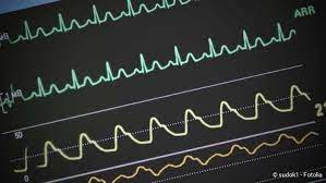 Vorhofflimmern Ursache Diagnose Und Behandlung Netdoktor