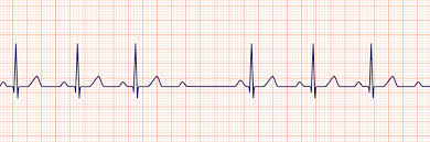 We did not find results for: Rhythm Recognition Acls Medical Training