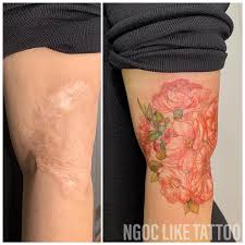 Today, cover scars with tattoos it is something very common in the world. Scar Cover Up Tattoos Help Women Regain Confidence In Their Bodies