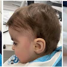 CBPΔCH1/ΔCH1 mice display craniofacial anomalies. (A) CBPΔCH1/ΔCH1 mice... 