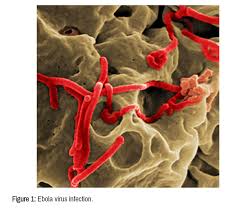Consult a doctor for medical advice. Ebola Virus Outcomes