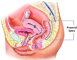 A female dog's reproductive system has similar organs as a human's. Drawing Of Female Pelvis Midsagittal View Shows The Anatomy Of The Download Scientific Diagram