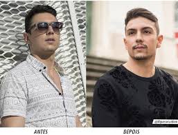 Saiba aqui tudo sobre a bichectomia: Homens Que Se Cuidam Como Afinar O Rosto Masculino Se Liga Nas Dicas