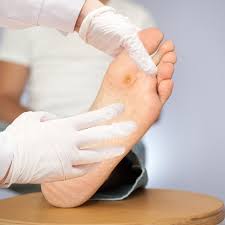 There are ways to remove blemishes and keep them from coming back again. Warts Fairfield Podiatry