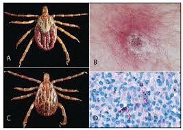 Image result for Rickettsiae