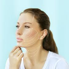 Donna Kelleher-Yassen, NP