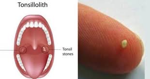 Pin On Health