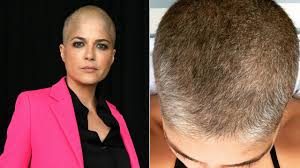 Jul 12, 2021 · these fantastic bangs are made of real human hair. Selma Blair Shares Patchy Charcoal Post Chemo Hair Growth On Instagram Allure