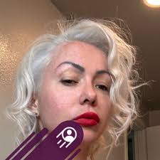 Keto rash: a potential side effect of low carb intake