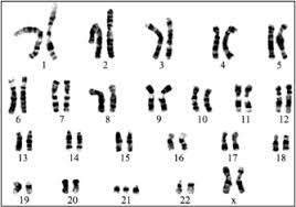Sim, eu sou um dos que fiz isso. Questao 634896 19 Ufn Inverno 2015 Estuda Com Enem O Maior Site De Questoes Para O Enem E Vestibulares Do Brasil