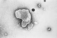 Respiratory syncytial virus (rsv) infection. Respiratory Syncytial Virus Wikipedia