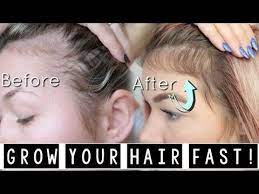 Brushing the growing hair encourages better circulation in the scalp and hence efficient delivery of nutrients and removal of waste products. Wellness Talk Cites That Hair Grows On The Head At A Rate Of About 0 5 Mm Daily Because Everyone Is Different The R Grow Baby Hair Baby Hair Growth Grow Hair