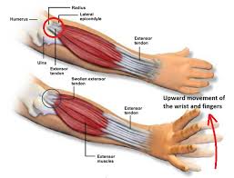 This is most often known as tennis elbow. Marimbabody Wrists Part 3 Tendons Laurel Black Music