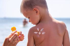 Image result for Sunburn