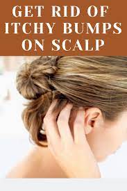 What Causes Itchy Bumps On Scalp And How You Can Get Rid Of Them In 2021 Itchy Bumps Dandruff Remedy Vitamins For Hair Loss