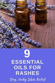 Itchy skin is a common problem that can be hard to diagnose. 9 Essential Oils For Rashes In 2020 Dry Itchy Skin Relief Essential Oils For Eczema Essential Oils For Rash Essential Oils For Skin