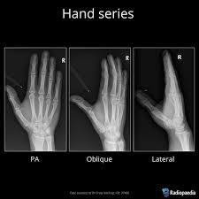 Image result for Normal Anatomic Position of the Hand and Wrist