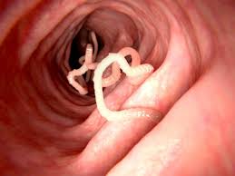 Intestinal Worms Pictures Symptoms And Treatment