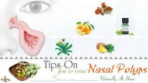 If you symptoms persist, talk to your doctor about changing your. 30 Tips On How To Treat Nasal Polyps Naturally At Home