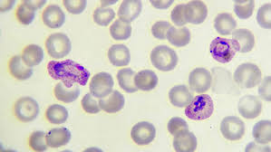 Your risk is increased if you live in or travel to an area where malaria is common. How Malaria Parasites Hide From The Human Immune System Science News