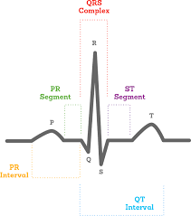 what is an ecg