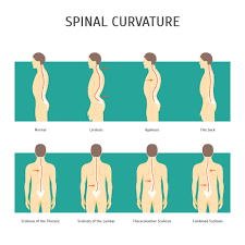 Questions and answers for it is sometimes called a bulging, protruding, or ruptured disk. Lower Back Pain Causes Treatments Exercises Back Pain Relief