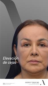 Andres Tobar Padilla MD (@dr_andrestobar) · Instagram 照片和视频