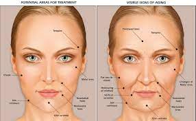 Extreme weight loss creates sagging jowls earlier or more drastically than typical. Best Procedure For Aging Sagging Jowls Salt Lake City St George Utah Patel Plastic Surgery
