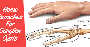 Pin On Home Remedies