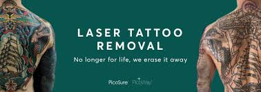 Wei jing loo and the laser technician at dermeffects, chassidy pazitny, have many years of combined experience performing laser treatments, including tattoo removal. Tattoo Removal London Picosure Tattoo Removal