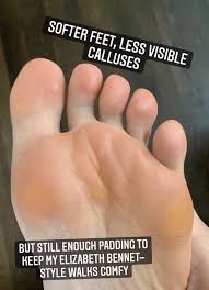 Dryness is the primary cause of peeling skin on the feet, so it's critical that you keep your skin. Baby Foot Review Gross Satisfying And Effective