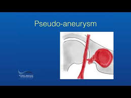 Image result for Pseudoeriosema