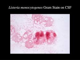 Try our newest study sets that focus on listeria monocytogenes gram stain to increase your studying efficiency and retention. Ppt Case Study Listeria Monocytogenes 2009 Powerpoint Presentation Free Download Id 1272861