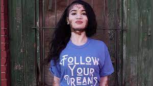 She Used To Spray Tan To Cover Her Vitiligo Now She Ll Never Hide Her True Beauty Video Abc News