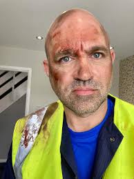 Throwing it right back to 'Match Day' ⚽️ @dylanb_actor @dalegrantactor  @keithfrenchofficial Using @bennyemakeup dirt & blood as always 🩸  #specialeffectsmakeupartist #specialeffectsmakeup #filmmakeup #fakeblood  #bennye