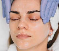 TCA (Trichloroacetic Acid) Peeling ▷ Removes Scars, Spots & Wrinkles |  Nescens© Clinic
