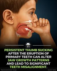 How many of you really know what the action of sucking your teeth means,  and why you would be «fetched a box» if you were to do it in the presence  of «