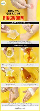 Hand sanitizers are a convenient way to clean your hands when soap and water aren't available. How To Get Rid Of Ringworm Kill The Infection With Home Remedies