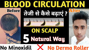 Regularly brushing hair, however, is actually good for it—brushing massages the scalp and helps improve blood flow and circulation. How To Increase Blood Circulation On Scalp For Hair Growth Hair Regrowth By Blood Circulation Youtube