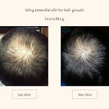 Hair Growth Success Essential Oils For Hair Essential Oils Rosemary Essential Oils