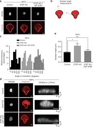 Young, a postdoc in tobias zech's lab at the university of liverpool, studies how the cytoskeleton coordinates cellular behavior in various diseases like in osteosarcoma, a bone cancer that's. Stef Tiam2 Mediated Rac1 Activity At The Nuclear Envelope Regulates The Perinuclear Actin Cap Nature Communications