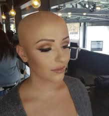 Woman with alopecia being trolled after dating show appearance