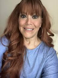 Embracing hair loss with alopecia