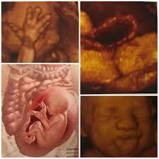 Your baby just keeps growing and growing. 26 Weeks Pregnant Size Of A Scallion Over 40 First Time Mom